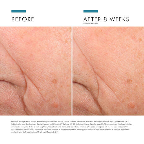 Skin Ceuticals Triple Lipid Restore 2:4:2