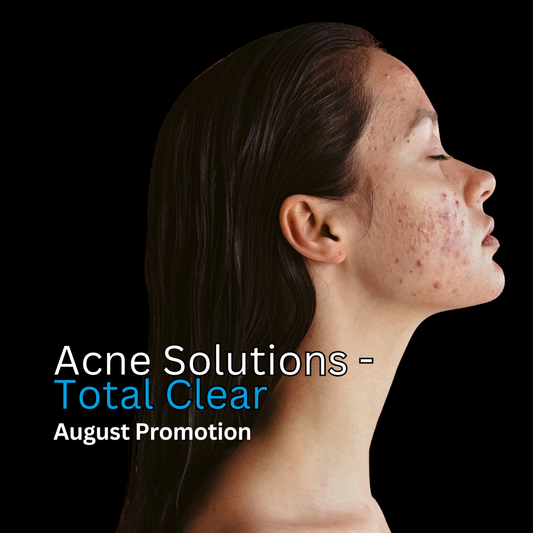 Acne Solutions - Total Clear (Moderate to Severe Acne)